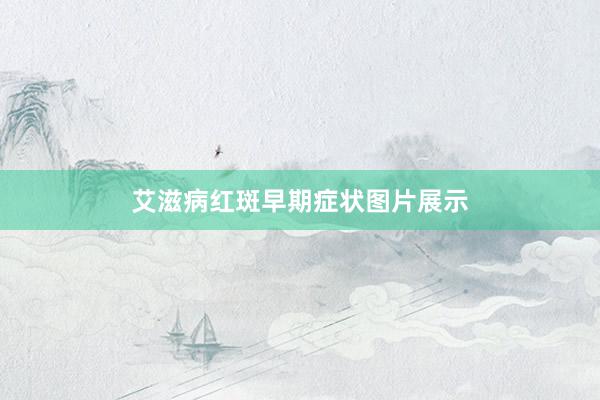 艾滋病红斑早期症状图片展示